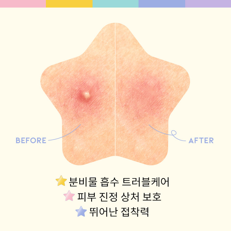 OOTD 트윙클 리틀스타 아크네 스팟패치(80매입)