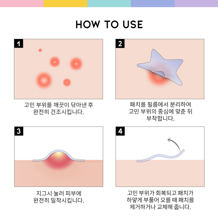 OOTD 트윙클 리틀스타 아크네 스팟패치(80매입)